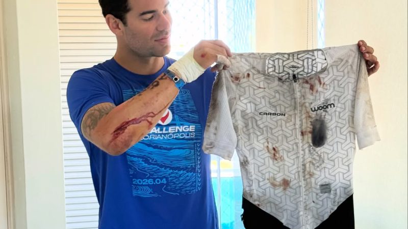 Renato Prono sufrió accidente en bici